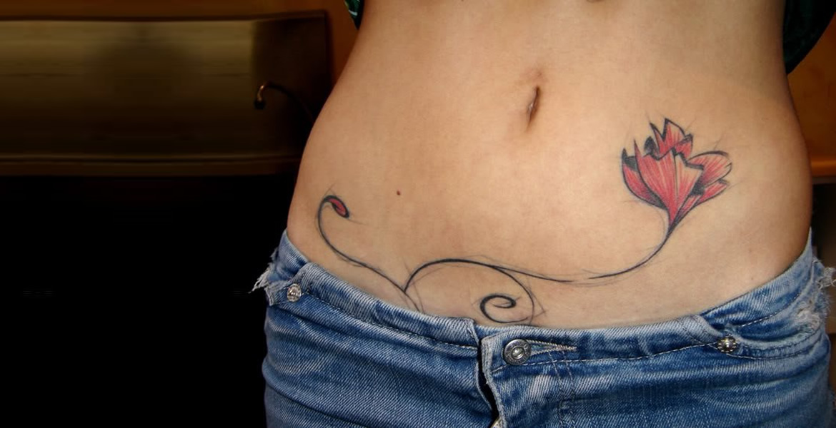 Preguntas Frecuentes sobre el borrado de tatuajes con láser