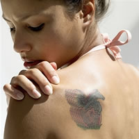 Spectra Tattoo Laser